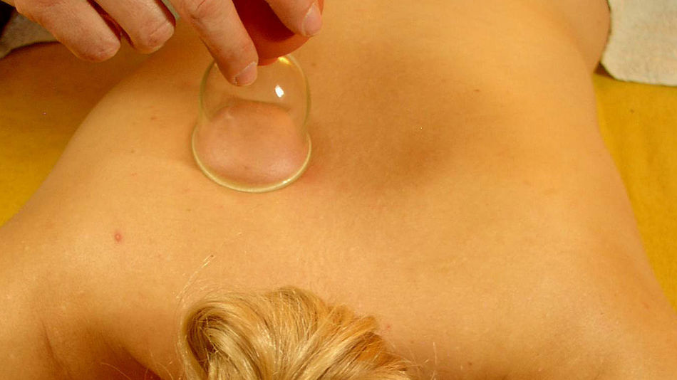 Schröpfkopfmassage